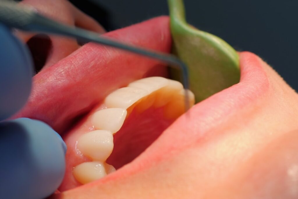 Dental Emergency Machesney Park