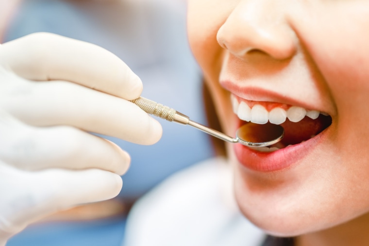Smile Makeover