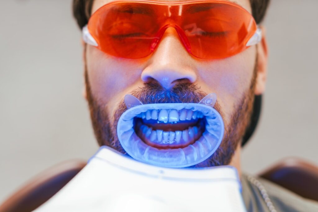Teeth-Whitening-Treatment-in-Machesney-Park
