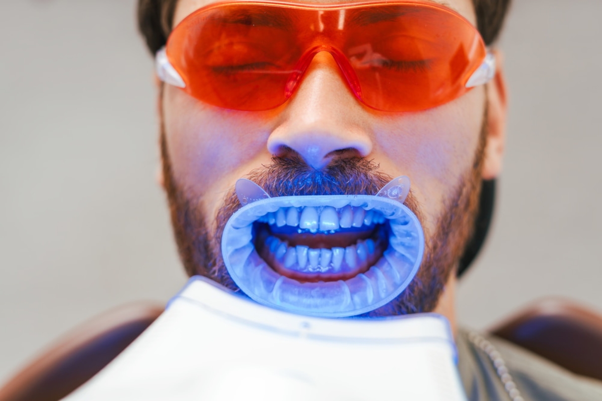 Teeth-Whitening-Treatment-in-Machesney-Park