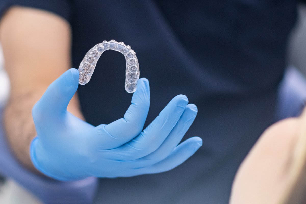 Close-up of a clear Invisalign aligner tray held in a gloved hand during dental treatment.