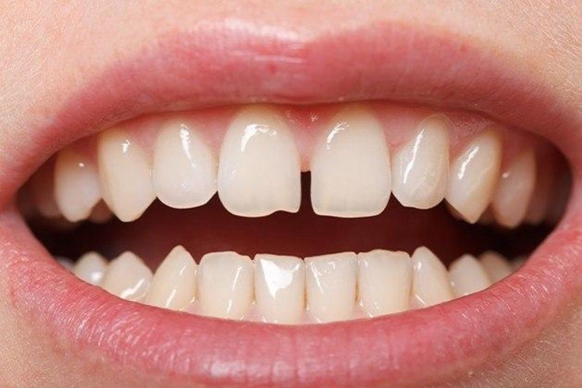 Close-up of an adult's healthy smile showing natural white teeth with proper alignment and no gaps.